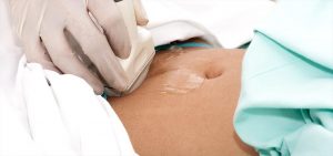 Read more about the article Ultrasound for Ovarian Reserve