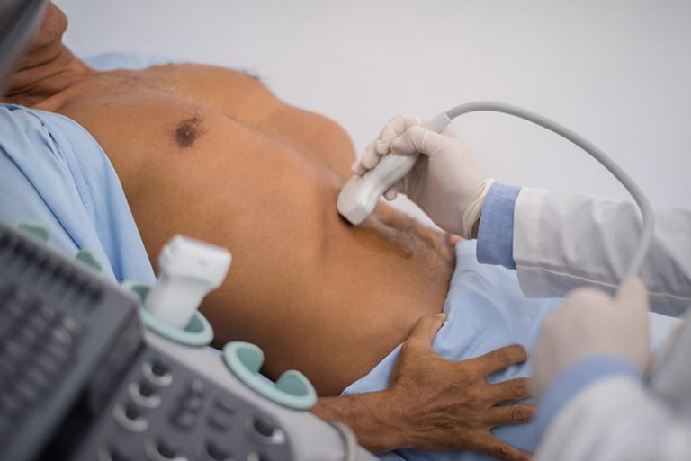 Read more about the article Abdominal Ultrasound FAQs