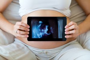 A pregnant woman holding a digital baby scan image from an ultrasound she performed at home