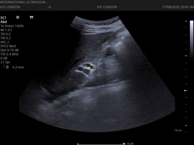 Read more about the article Understanding Your Ultrasound Report — A Patient’s Guide